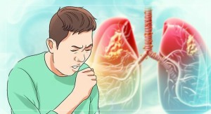 आज विश्व क्षयरोग दिवसः जनचेतनामूलक कार्यक्रम गरी मनाइँदै